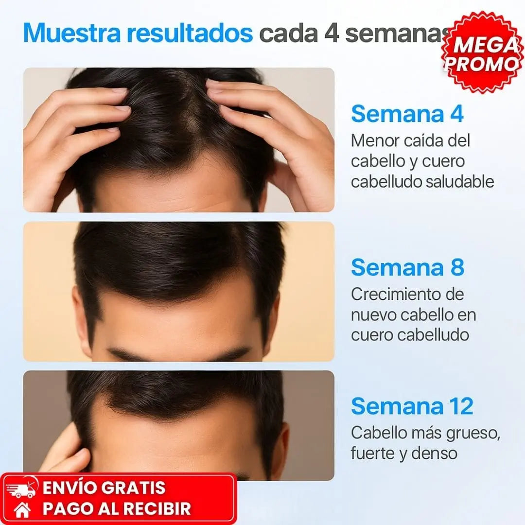 OFERTA ÚNICA 2X1: BODY WISE™ I Fórmula con romero y biotina para un cabello más fuerte y abundante Tienda Colombia 🇨🇴