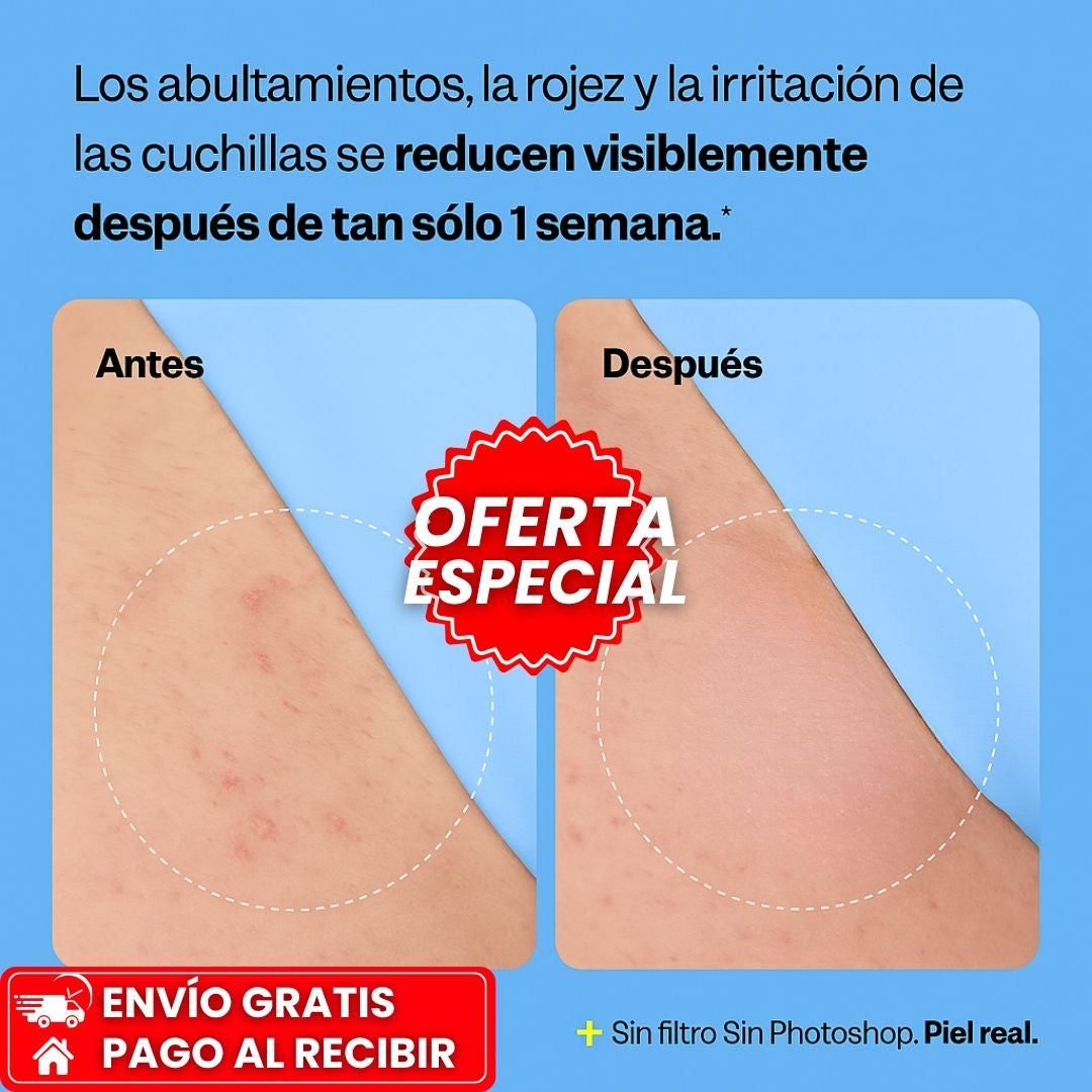 PEACH SLICES™: Exfoliante para Vellos Encarnados y Granitos con Efecto Suavizante y Calmante