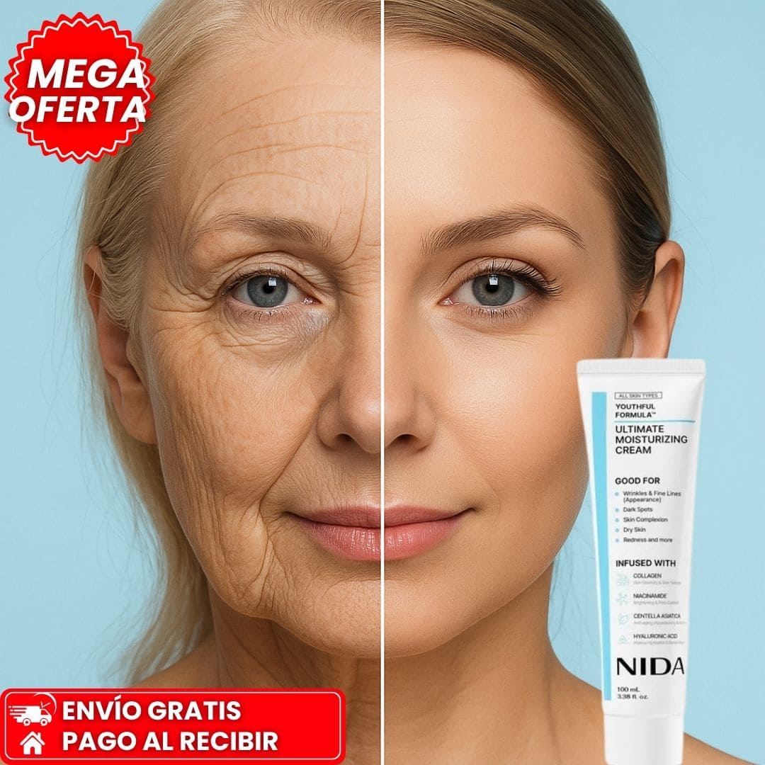 NIDA™ | Bótox coreano: despídete de las arrugas y manchas molestas