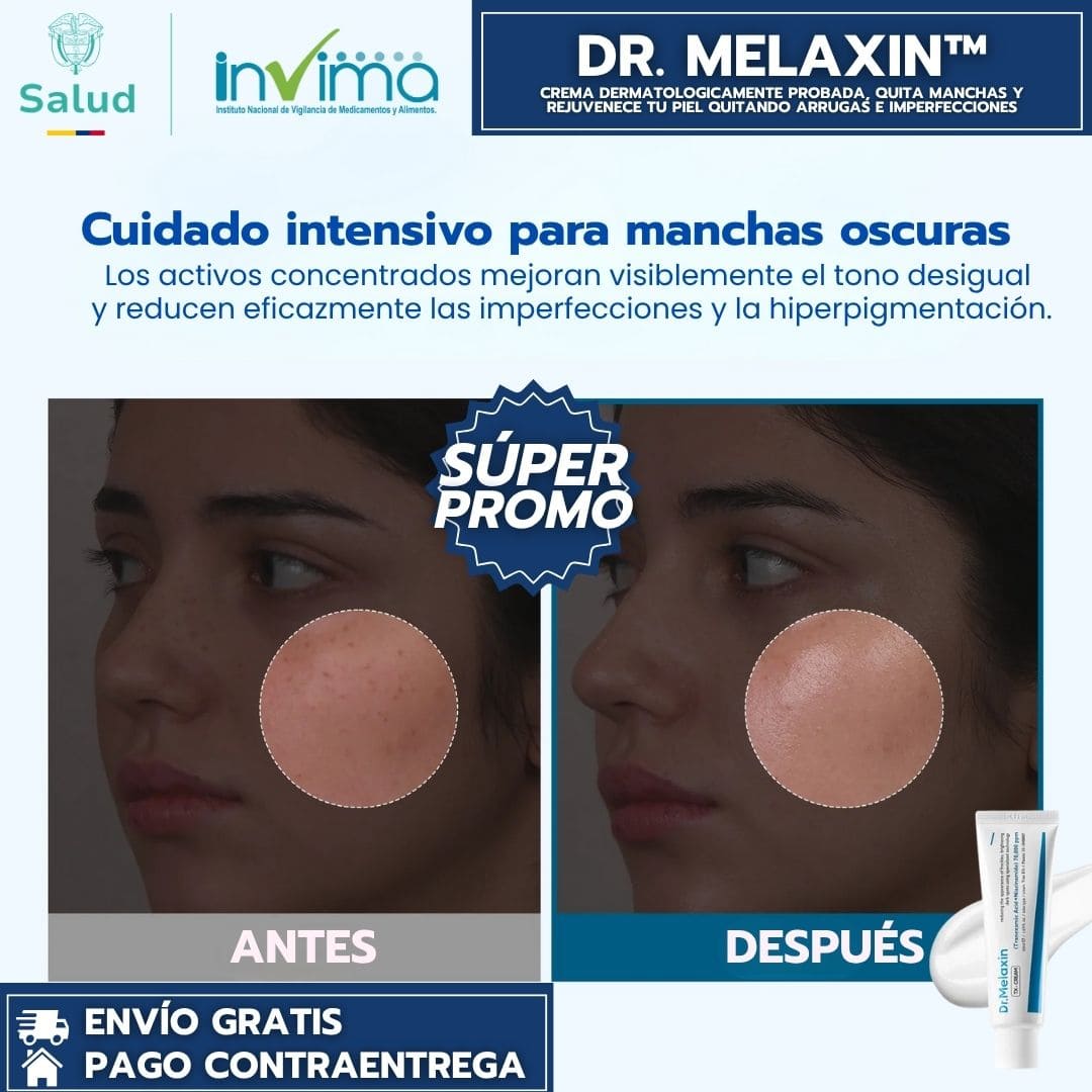 Dr Melaxin – Crema dermatológica avanzada quita manchas y rejuvenecedora