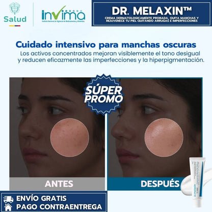 Dr Melaxin – Crema dermatológica avanzada quita manchas y rejuvenecedora