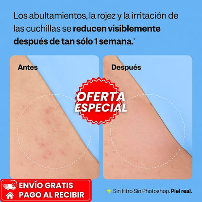 PEACH SLICES™: Exfoliante para Vellos Encarnados y Granitos con Efecto Suavizante y Calmante